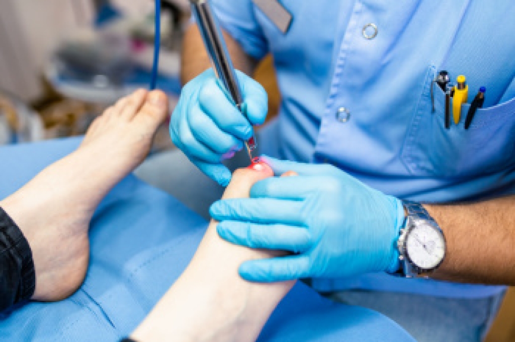Toenail Avulsion Surgery Can Bring Lasting Relief