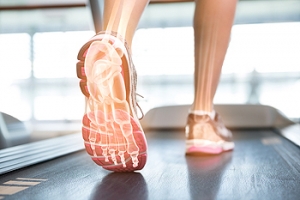 Preventing Foot Problems